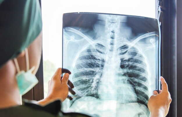 Firozabad News : बीच में न छोड़ें टीबी का उपचार, बढ़ सकती है परेशानी : डीटीओ