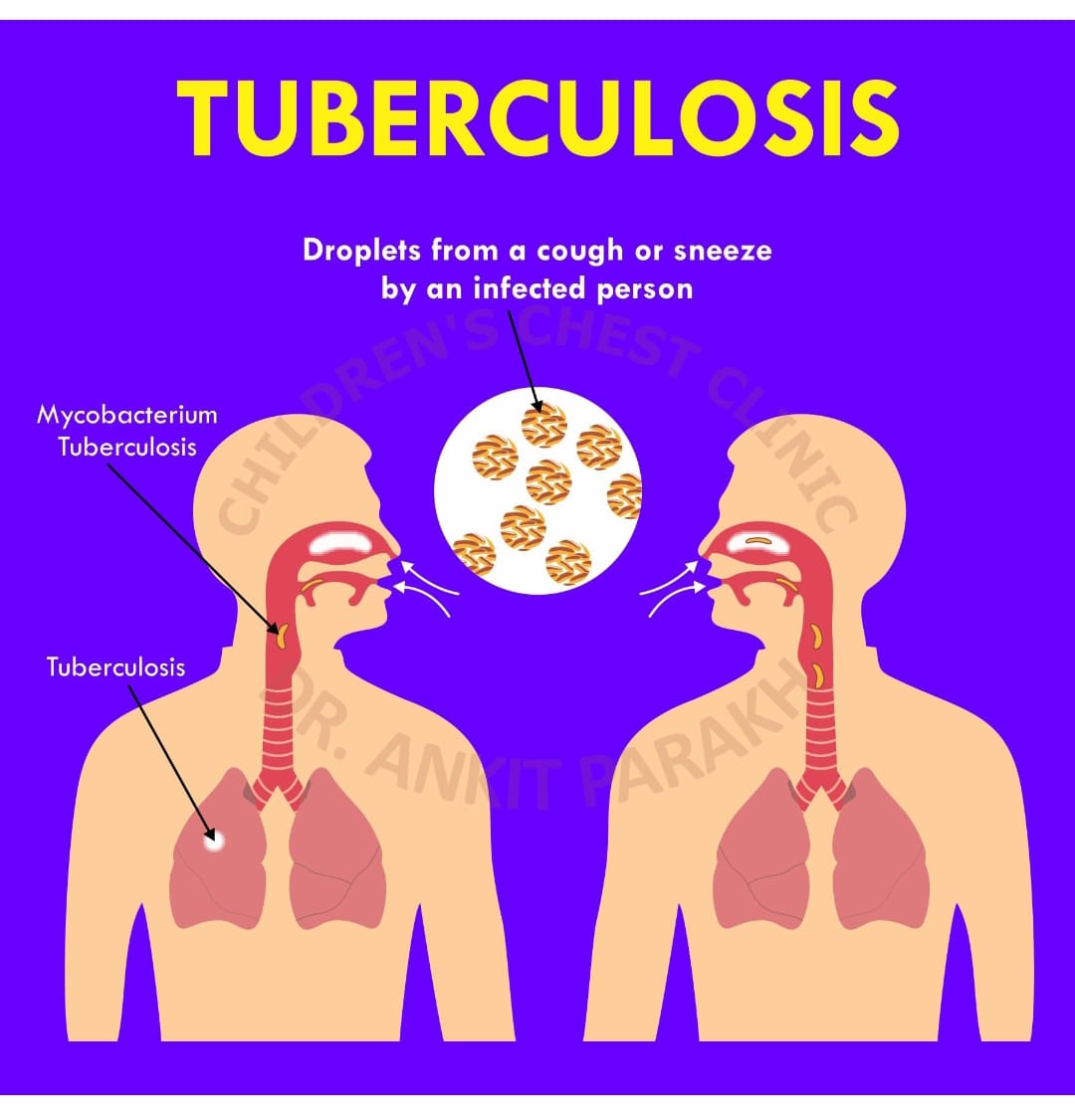 Firozabad News : जनपद में 4.5 करोड़ से ज्यादा टीबी रोगियों के खाते में हुआ भुगतान