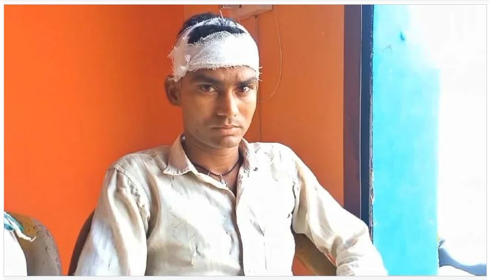 पति कर रहा था ये काम, नहीं उठाया फोन, घर पहुंचा तो भड़की पत्नी, ईंट से फोड़ दिया सिर