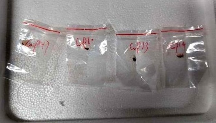 तो क्या अब चीन फफूंदी के जरिए बनाना चाहता है दहशत का माहौल!