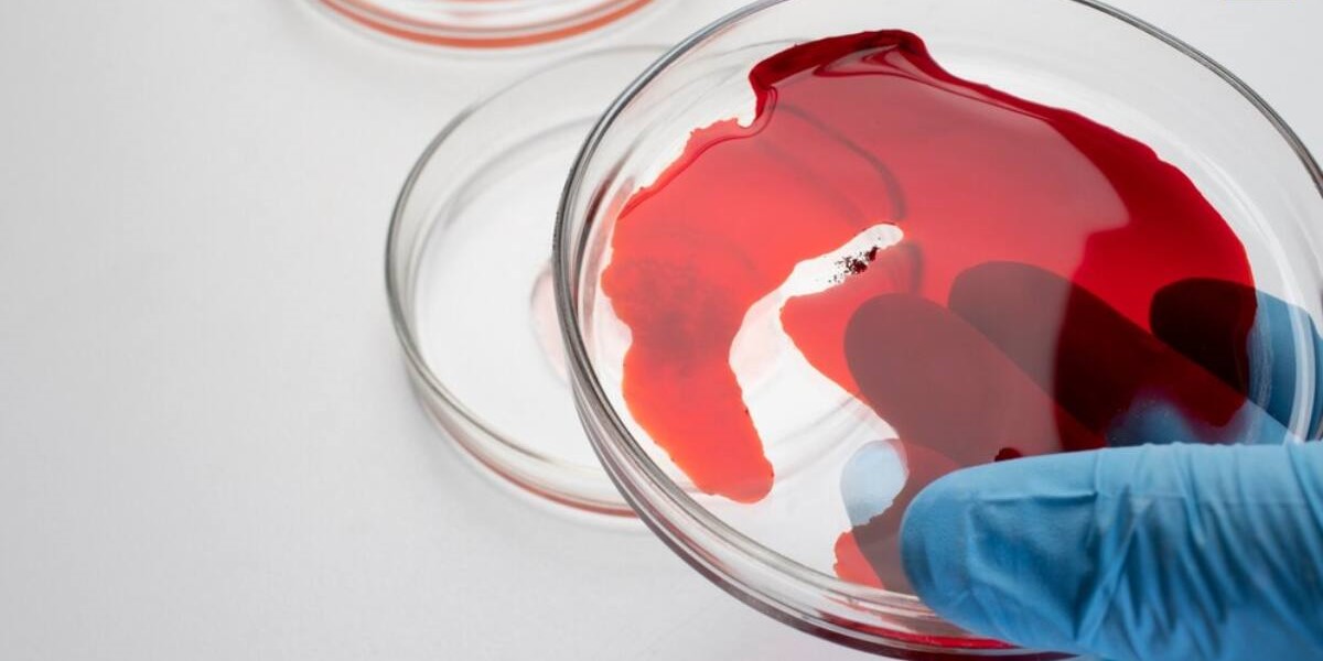 तो आदमी के शरीर में चढ़ाया जा रहा जानवरों का खून?